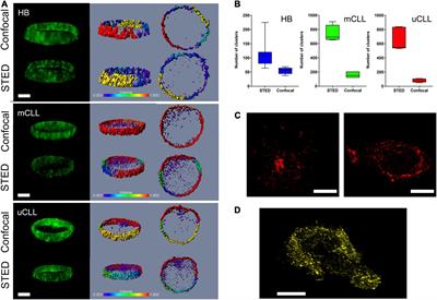 3D-STED Super-Resolution Microscopy Reveals Distinct Nanoscale Organization of the Hematopoietic Cell-Specific Lyn Substrate-1 (HS1) in Normal and Leukemic B Cells